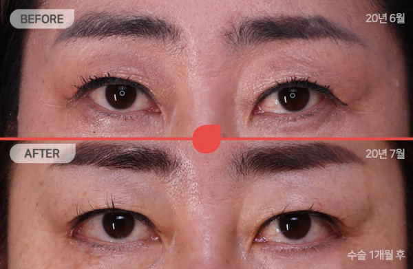 정면
