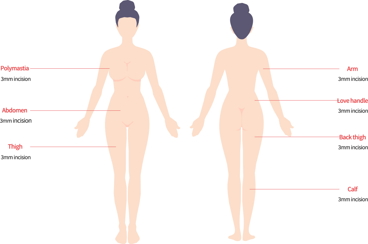 body_lip01 model img