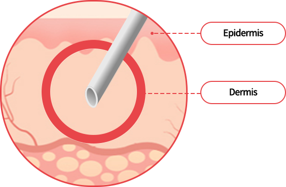 hand_img02 comparison02