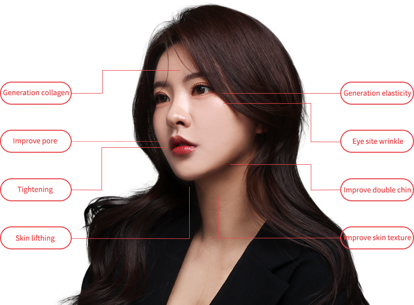 oligio region model img