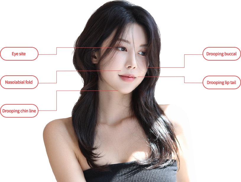 mini lifting model img