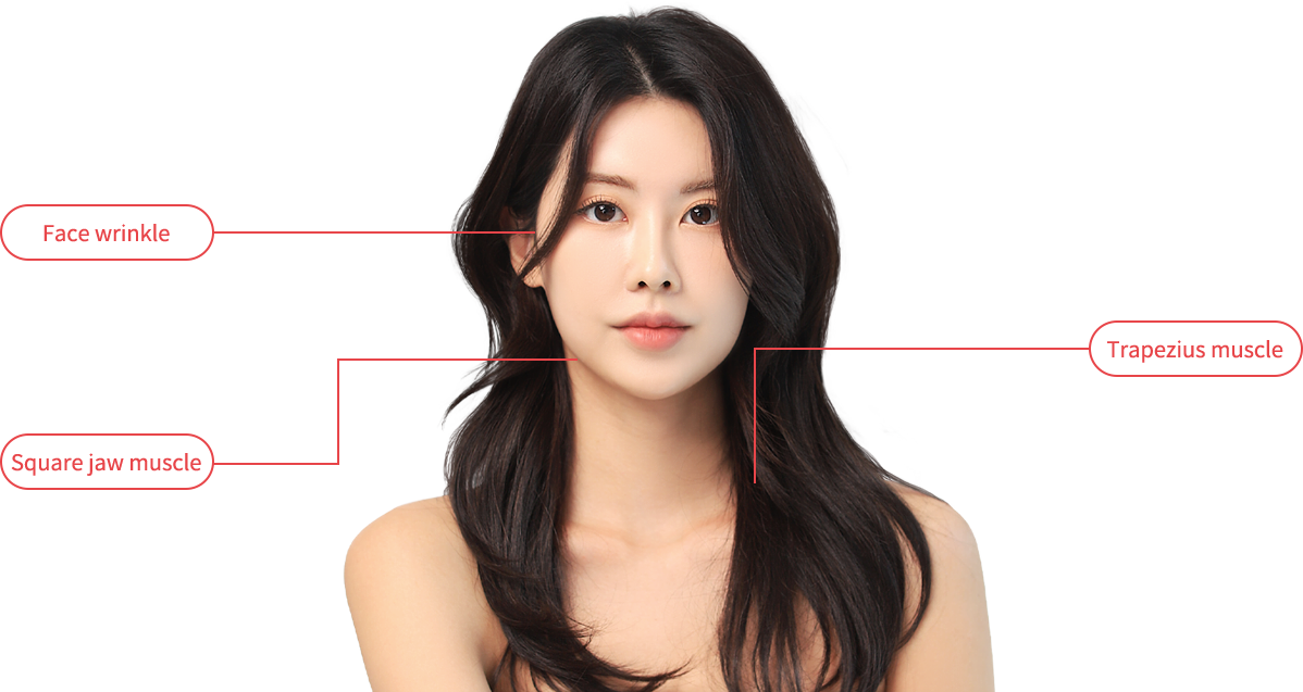 BotulinumToxin model img