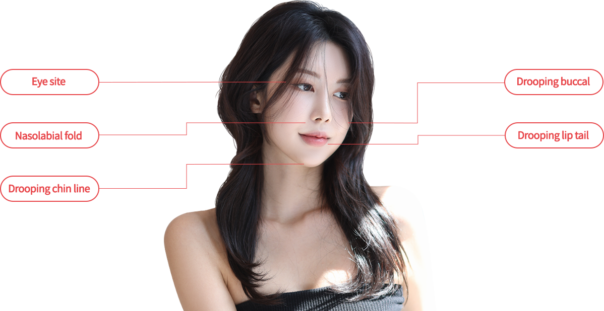 mini lifting model img