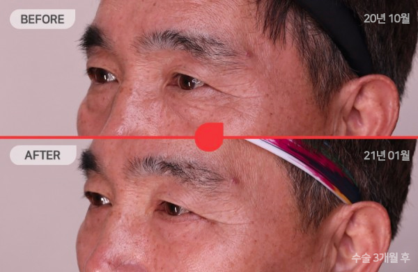 45度