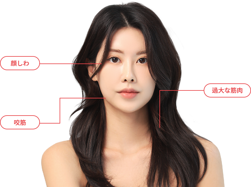 BotulinumToxin region model img
