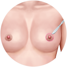 nipple_img11