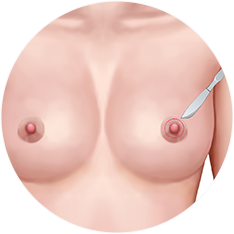 nipple_img13