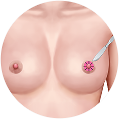 nipple_img14