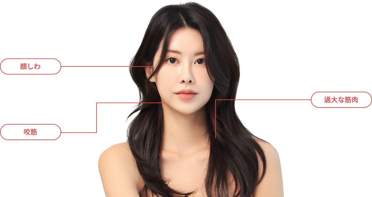 BotulinumToxin model img