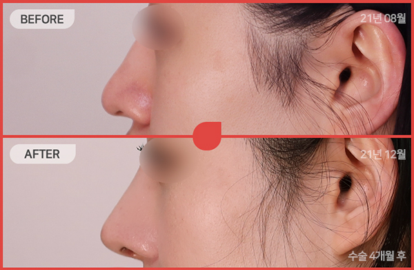 ด้านข้างของใบหน้า