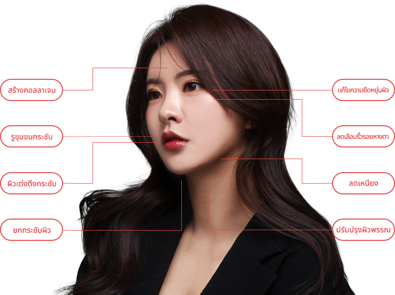 oligio region model img