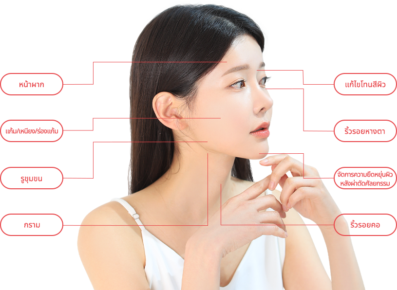 ulthera region model img