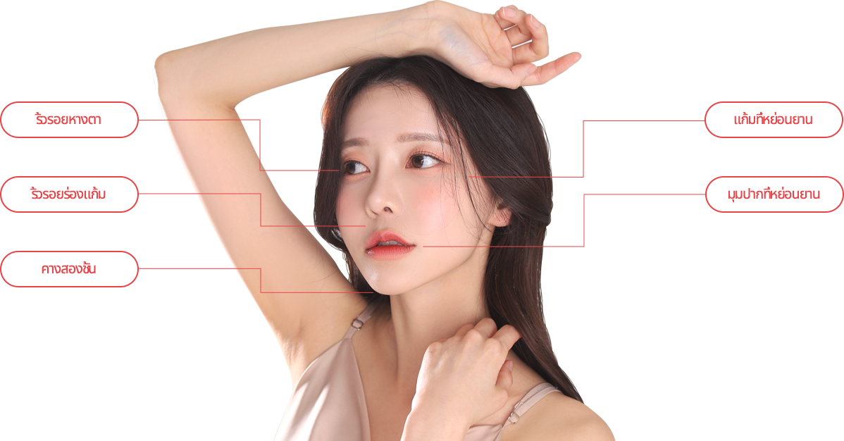 mini incisio model img