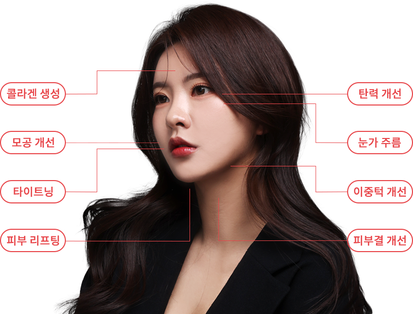 oligio region model img