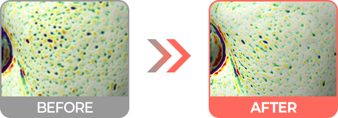 리투오효과 피부결 & 피부결밀도 개선