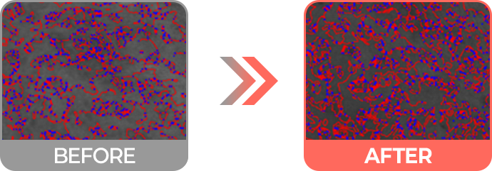 리투오효과 피부결 & 피부결밀도 개선