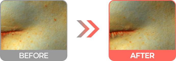 리투오 효과 기미/잡티/광채 개선