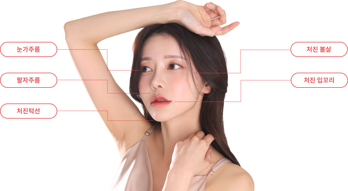 mini incisio model img