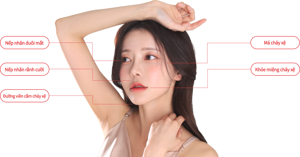 mini incisio model img