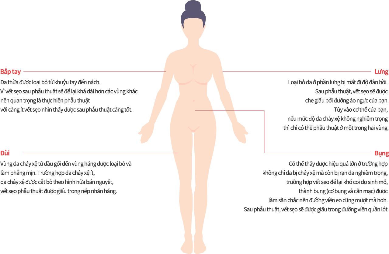 body_lift model img